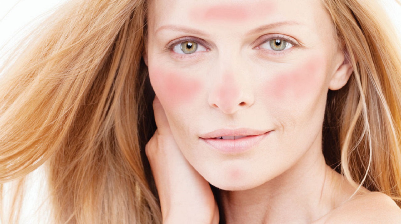 rosacea couperose creme 