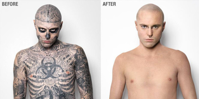 dermablend tatuaggi